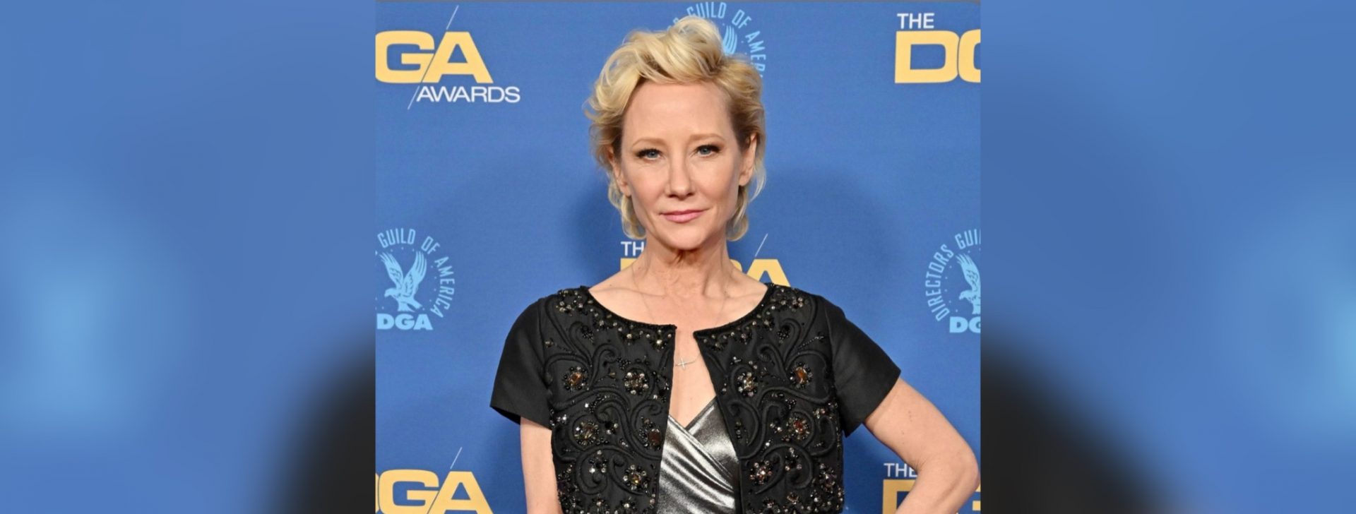 Anne Heche Dies At Age 53 From Brain Injury - SmashDaTopic